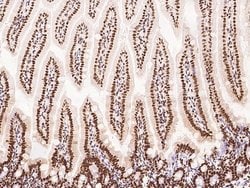 Invitrogen PTBP1 Polyclonal Antibody 100 &mu;L; Unconjugated:Antibodies,
