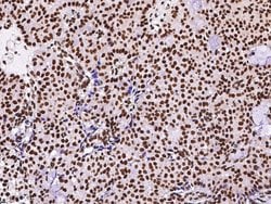 Invitrogen PTBP1 Polyclonal Antibody 100 &mu;L; Unconjugated:Antibodies,