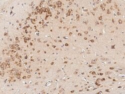 Invitrogen CD45 Polyclonal Antibody 100 &mu;L; Unconjugated:Antibodies,