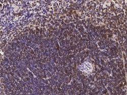 Invitrogen CD45 Polyclonal Antibody 100 &mu;L; Unconjugated:Antibodies,