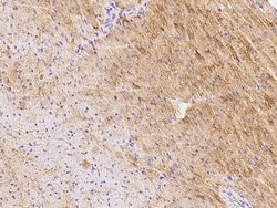 Invitrogen GFR alpha-3 Polyclonal Antibody 100 &mu;L; Unconjugated:Antibodies,