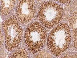 Invitrogen GFR alpha-3 Polyclonal Antibody 100 &mu;L; Unconjugated:Antibodies,