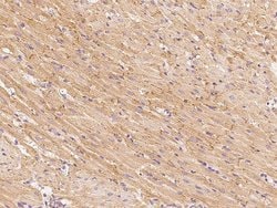 Invitrogen GFR alpha-3 Polyclonal Antibody 100 &mu;L; Unconjugated:Antibodies,