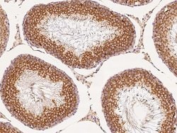 Invitrogen GFR alpha-3 Polyclonal Antibody 100 &mu;L; Unconjugated:Antibodies,