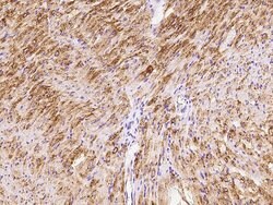 Invitrogen GLUT4 Polyclonal Antibody 100 &mu;L; Unconjugated:Antibodies,