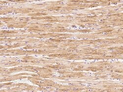 Invitrogen GLUT4 Polyclonal Antibody 100 &mu;L; Unconjugated:Antibodies,