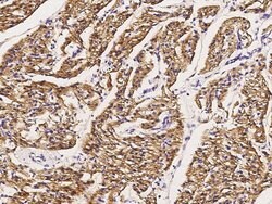 Invitrogen GLUT4 Polyclonal Antibody 100 &mu;L; Unconjugated:Antibodies,