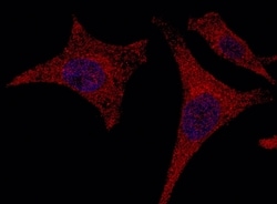 Invitrogen alanyl-tRNA Synthetase Polyclonal Antibody 100 &mu;L; Unconjugated:Antibodies,