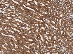 Invitrogen alanyl-tRNA Synthetase Polyclonal Antibody 100 &mu;L; Unconjugated:Antibodies,