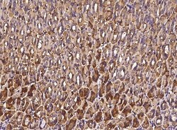 Invitrogen alanyl-tRNA Synthetase Polyclonal Antibody 100 &mu;L; Unconjugated:Antibodies,