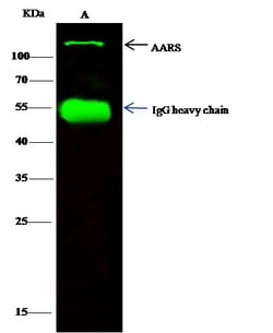 Invitrogen alanyl-tRNA Synthetase Polyclonal Antibody 100 &mu;L; Unconjugated:Antibodies,