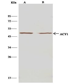 Invitrogen Aminoacylase Polyclonal Antibody 100 &mu;L; Unconjugated:Antibodies,