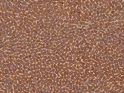 Invitrogen Butyrylcholinesterase Polyclonal Antibody 100 &mu;L; Unconjugated:Antibodies,