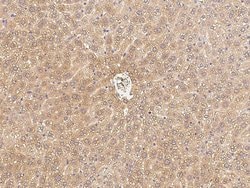 C1QB Polyclonal Antibody:Antibodies, Polyclonal