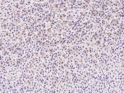 C1QB Polyclonal Antibody:Antibodies, Polyclonal