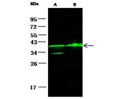 Invitrogen Carbonic Anhydrase X Polyclonal Antibody 100 &mu;L; Unconjugated:Antibodies,