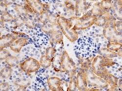 Invitrogen Carbonic Anhydrase XII Polyclonal Antibody 100 &mu;L; Unconjugated:Antibodies,