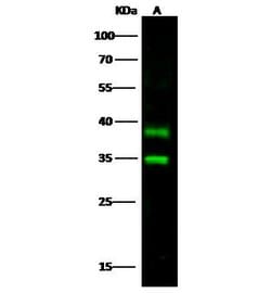 Invitrogen Carbonic Anhydrase XIV Polyclonal Antibody 100 &mu;L; Unconjugated:Antibodies,