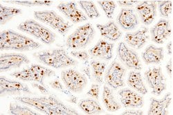 Invitrogen Carbonic Anhydrase II Polyclonal Antibody 100 &mu;L | Buy Online | Invitrogen&trade; | Fisher Scientific