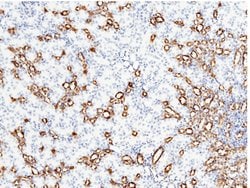 Invitrogen Carbonic Anhydrase II Polyclonal Antibody 100 &mu;L | Buy Online | Invitrogen&trade; | Fisher Scientific