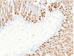 Invitrogen Carbonic Anhydrase II Polyclonal Antibody 100 &mu;L | Buy Online | Invitrogen&trade; | Fisher Scientific