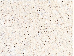Invitrogen Carbonic Anhydrase II Polyclonal Antibody 100 &mu;L | Buy Online | Invitrogen&trade; | Fisher Scientific