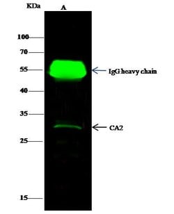 Invitrogen Carbonic Anhydrase II Polyclonal Antibody 100 &mu;L | Buy Online | Invitrogen&trade; | Fisher Scientific