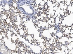 Invitrogen Carbonic Anhydrase IV Polyclonal Antibody 100 &mu;L; Unconjugated:Antistoffer