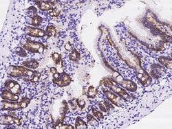 Invitrogen&trade;&nbsp;Carbonic Anhydrase IX Polyclonal Antibody