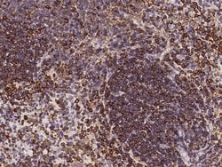Invitrogen CD180 Polyclonal Antibody 100 &mu;L; Unconjugated:Antibodies,