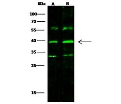 Invitrogen CD2 Polyclonal Antibody 100 &mu;L; Unconjugated:Antibodies,