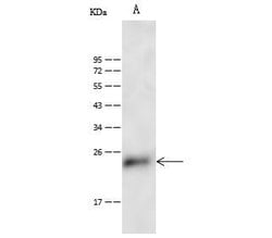 Invitrogen CD53 Polyclonal Antibody 100 &mu;L; Unconjugated:Antibodies,