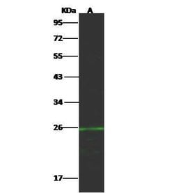 Invitrogen CD70 Polyclonal Antibody 100 &mu;L; Unconjugated:Antibodies,