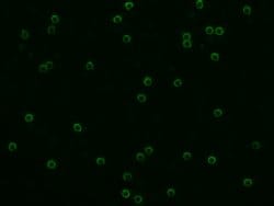 Invitrogen CD8 alpha Polyclonal Antibody 100 &mu;L; Unconjugated:Antibodies,