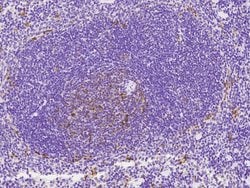 Invitrogen CD8 alpha Polyclonal Antibody 100 &mu;L; Unconjugated:Antibodies,
