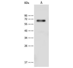 Invitrogen CD96 Polyclonal Antibody 100 &mu;L; Unconjugated:Antibodies,