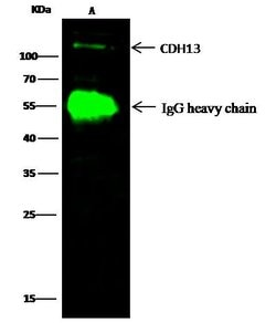 Invitrogen H-cadherin Polyclonal Antibody 100 &mu;L; Unconjugated:Antibodies,