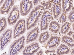 Invitrogen&trade;&nbsp;CDH17 Polyclonal Antibody