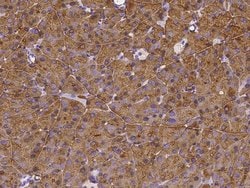 Invitrogen CEL Polyclonal Antibody 100 &mu;L; Unconjugated:Antibodies,