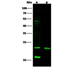 CRP Polyclonal Antibody 100 &mu;L | Buy Online | Thermo Scientific | Fisher Scientific