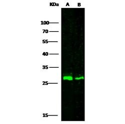 Invitrogen Cathepsin A Polyclonal Antibody 100 &mu;L; Unconjugated:Antibodies,