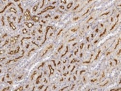 Invitrogen CD249 Polyclonal Antibody 100 &mu;L; Unconjugated:Antibodies,