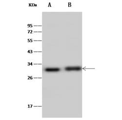 Invitrogen ERAS Polyclonal Antibody 100 &mu;L; Unconjugated:Antibodies,