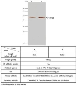 Invitrogen EVI2B Polyclonal Antibody 100 &mu;L | Buy Online | Invitrogen&trade; | Fisher Scientific