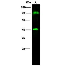 Invitrogen CD64 Polyclonal Antibody 100 &mu;L; Unconjugated:Antibodies,