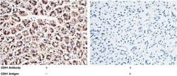 Invitrogen E-cadherin Polyclonal Antibody 100 &mu;L | Buy Online | Invitrogen&trade; | Fisher Scientific