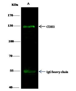Invitrogen E-cadherin Polyclonal Antibody 100 &mu;L | Buy Online | Invitrogen&trade; | Fisher Scientific