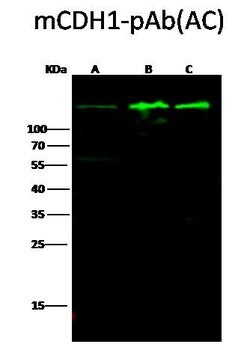 Invitrogen E-cadherin Polyclonal Antibody 100 &mu;L | Buy Online | Invitrogen&trade; | Fisher Scientific