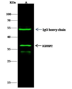 Invitrogen IGFBP2 Polyclonal Antibody 100 &mu;L | Buy Online | Invitrogen&trade; | Fisher Scientific