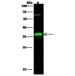 Invitrogen IGFBP2 Polyclonal Antibody 100 &mu;L | Buy Online | Invitrogen&trade; | Fisher Scientific